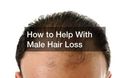 How to Help With Male Hair Loss